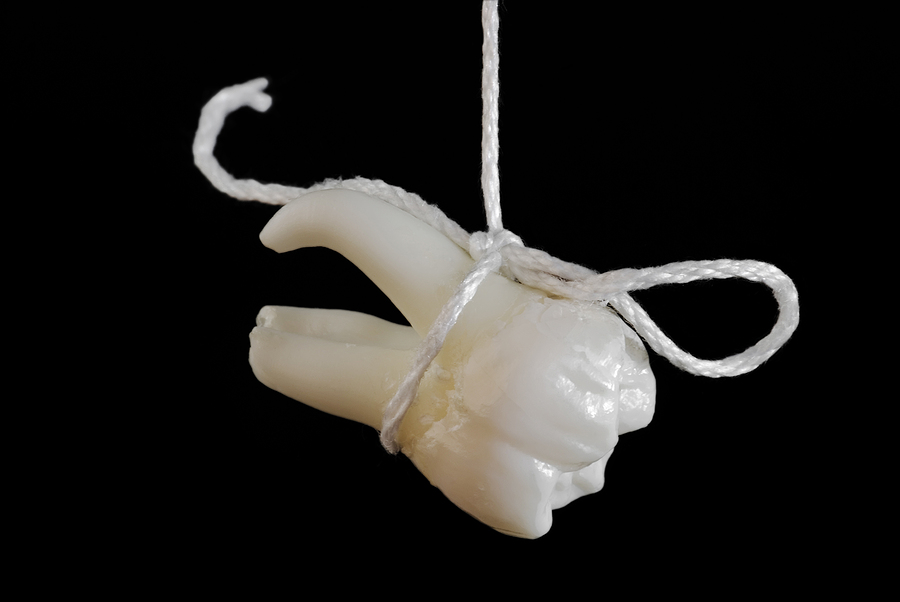 Everything You Need to Know About Tooth Extractions: Your Guide to a Smooth Recovery