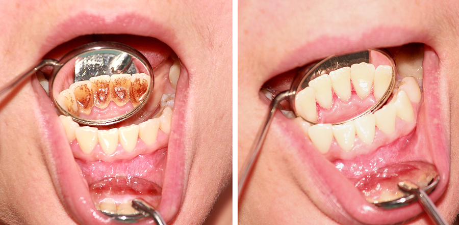 Understanding Oral Pathology: Diagnosis and Treatment of Oral Diseases Understanding Oral Pathology: Diagnosis and Treatment of Oral Diseases