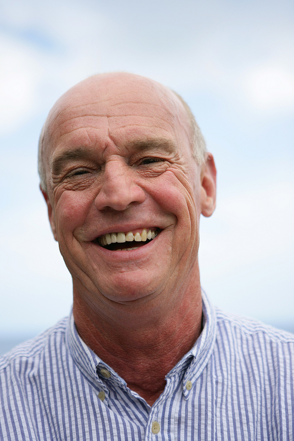 Osseointegration and Its Role in the Longevity of Dental Implants: What You Need to Know