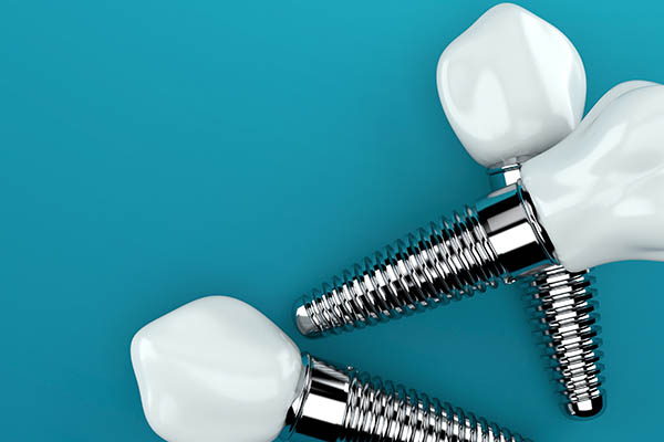 An Implant Dentist Shares About The Tooth Replacement Timeline