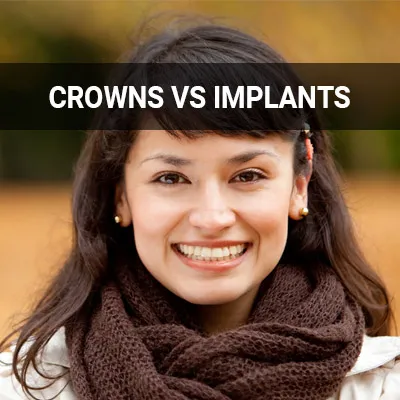 Visit our Crowns vs. Implants page