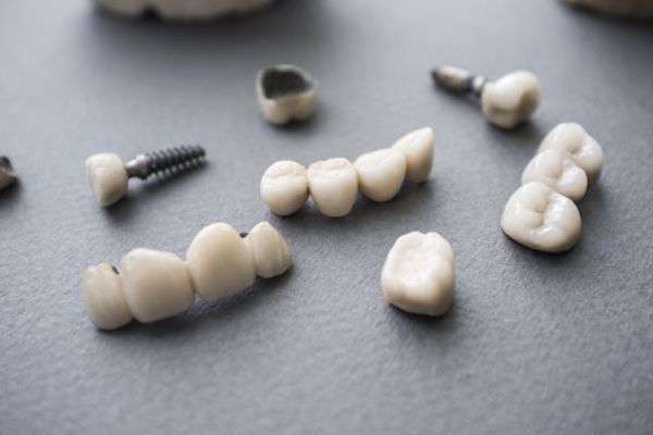 Types of Dental Implants from Wilson Oral Surgery in Santa Maria, CA