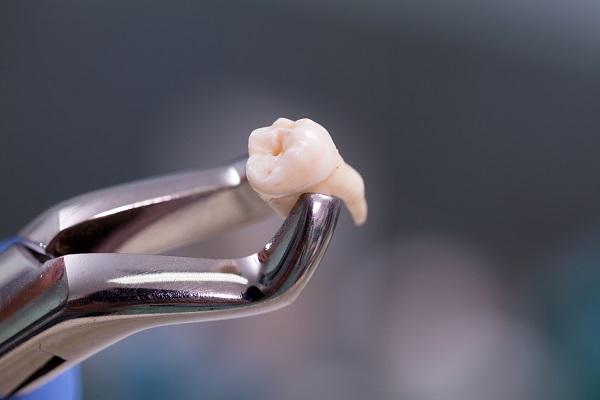 When To Go To An Oral Surgeon For A Wisdom Tooth Extraction?